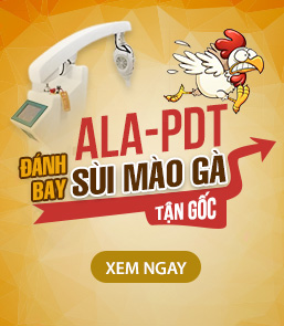 quảng cáo